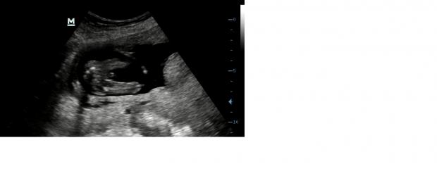 Name:  Nr1.jpg
Views: 162
Size:  10.6 KB