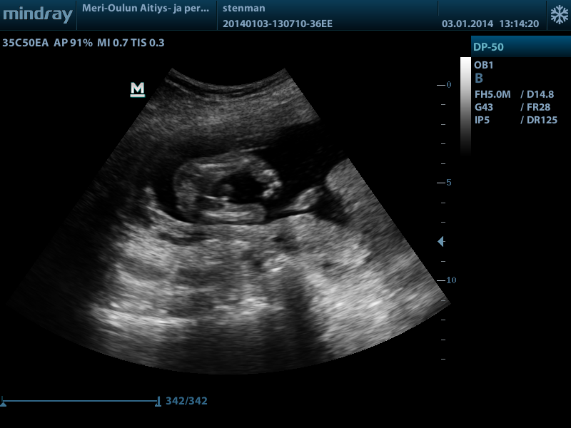 Name:  201401031314220004OB.BMP
Views: 189
Size:  1.37 MB