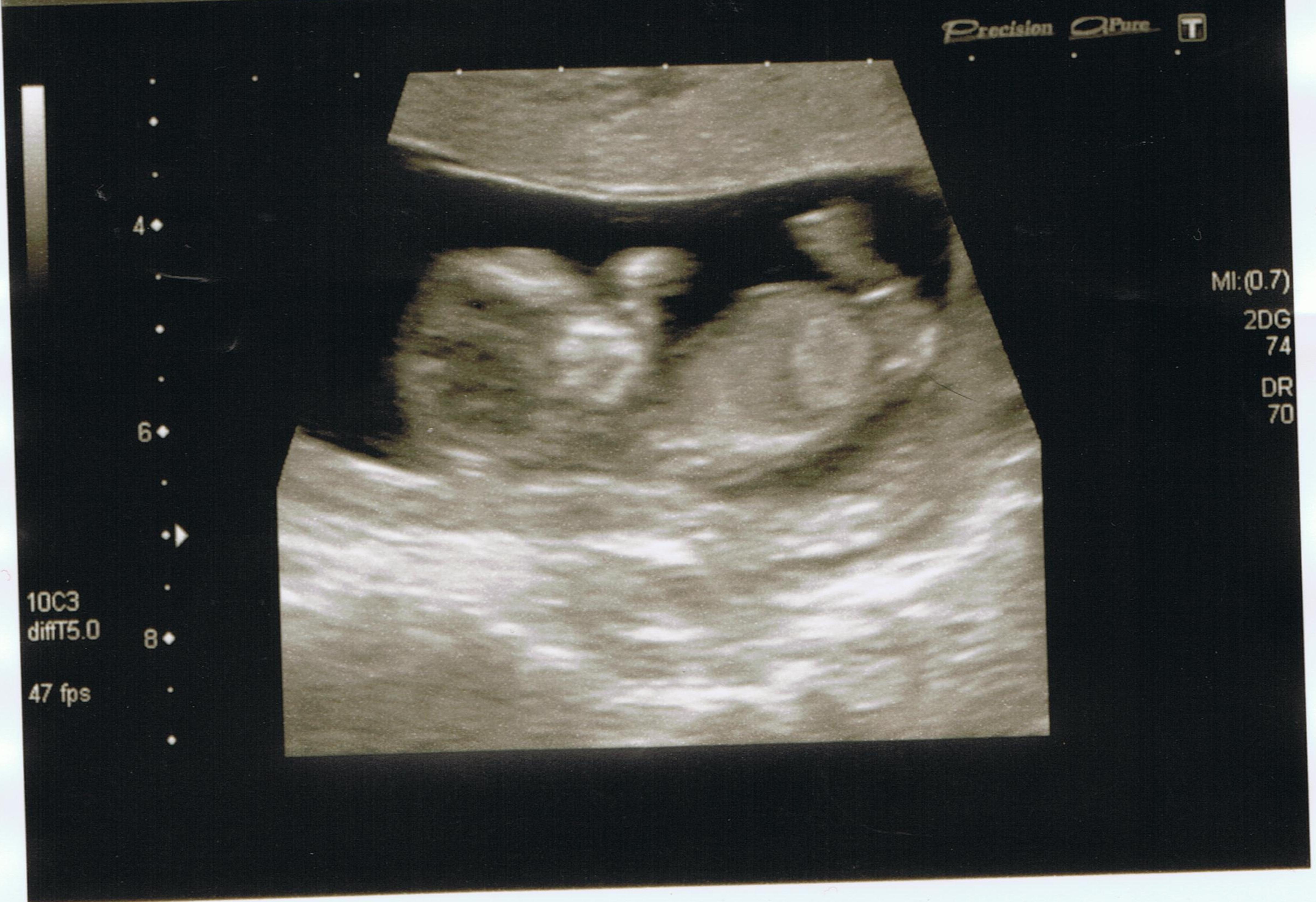 Name:  baby 08.01.14 x4.jpeg
Views: 163
Size:  1.07 MB