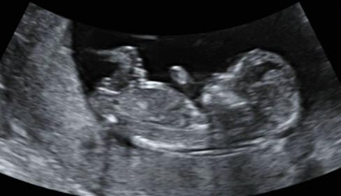 Name:  babybits.jpg
Views: 176
Size:  17.5 KB