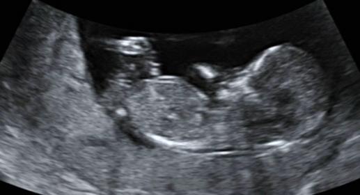 Name:  babybits2.jpg
Views: 198
Size:  19.0 KB