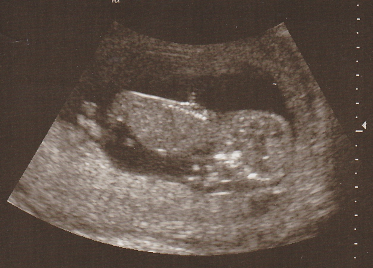 Name:  12 weeks- upside down no info.jpg
Views: 101
Size:  214.0 KB