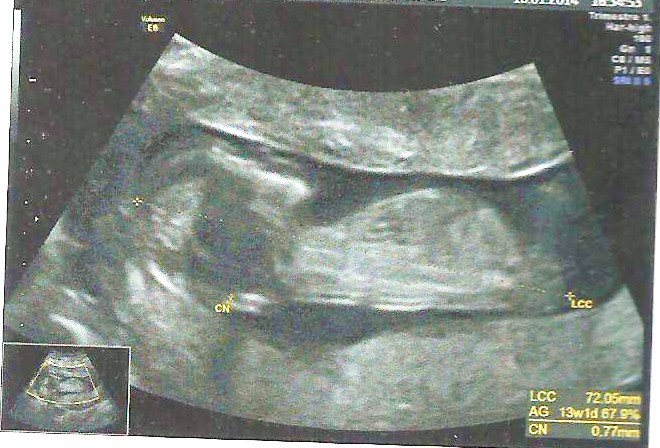 Name:  scan pic.jpg
Views: 120
Size:  101.7 KB