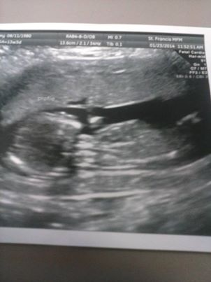 Name:  13 weeks picture.bmp
Views: 165
Size:  357.4 KB