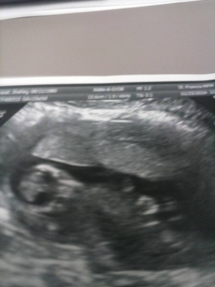 Name:  13 weeks face.bmp
Views: 124
Size:  1.98 MB