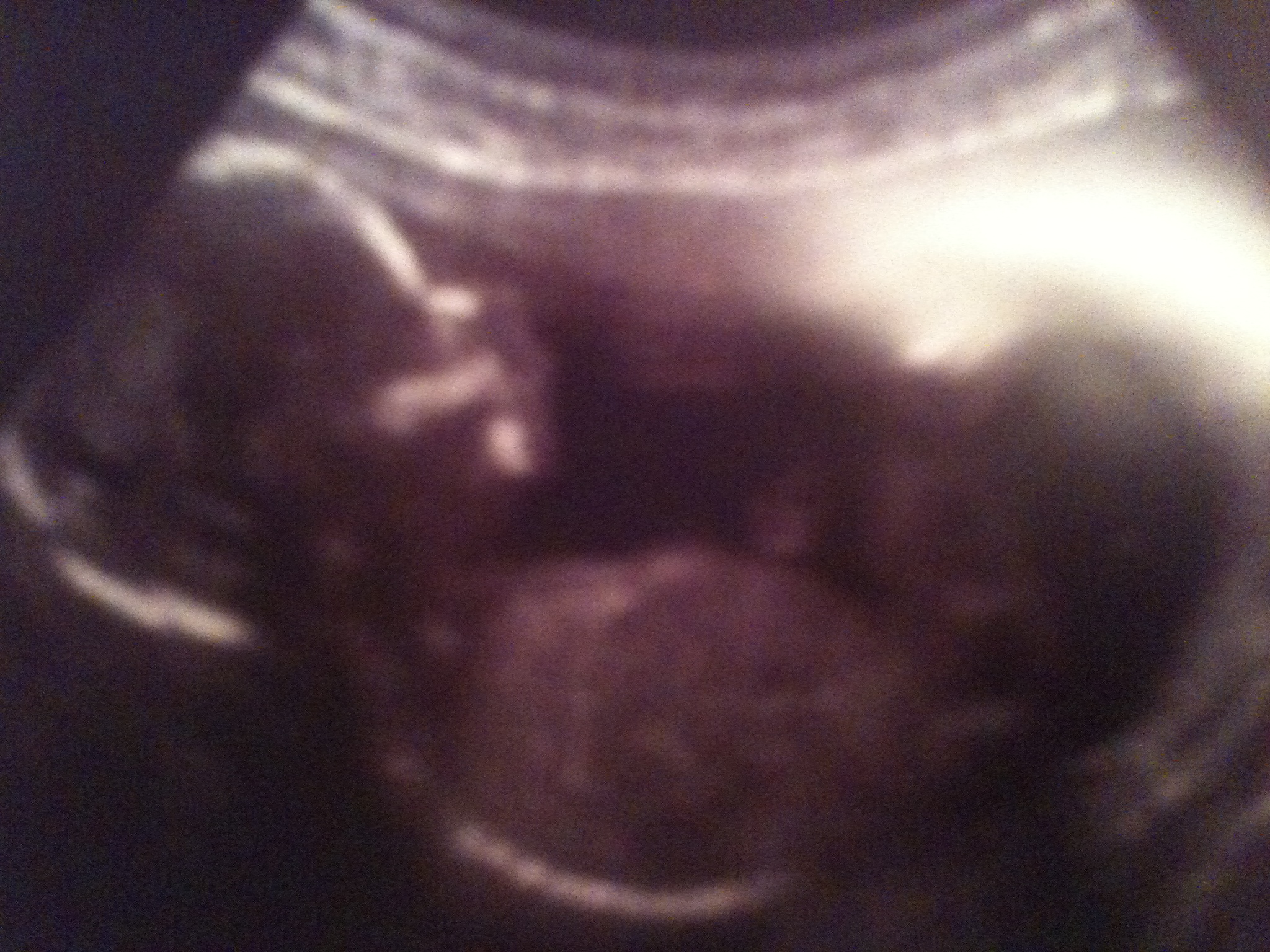 Name:  16 wks.jpg
Views: 299
Size:  1.18 MB
