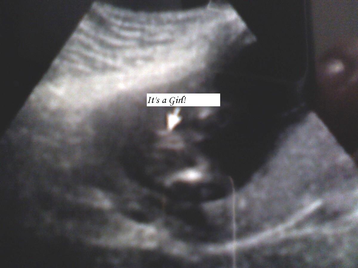 Name:  Its a Girl!.jpeg
Views: 20331
Size:  74.8 KB