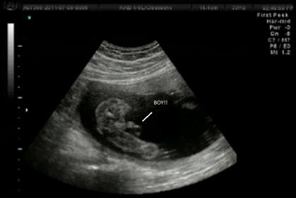 Name:  boy3.jpg
Views: 829
Size:  11.1 KB