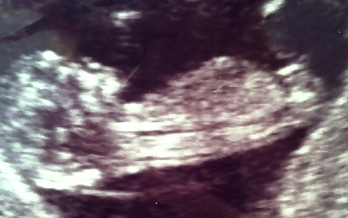 Name:  image.jpg
Views: 515
Size:  48.0 KB