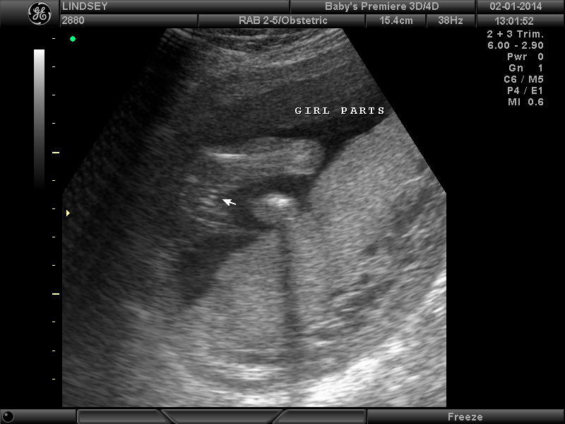 Name:  BABYS PREMIERE_6.JPG
Views: 344
Size:  144.3 KB