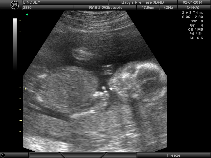 Name:  BABYS PREMIERE_18.JPG
Views: 219
Size:  150.7 KB