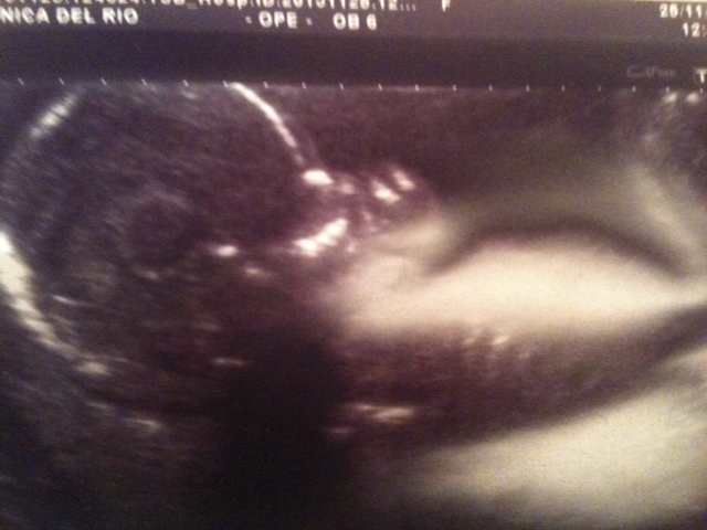 Name:  Baby Rooney 1.jpg
Views: 85
Size:  108.6 KB