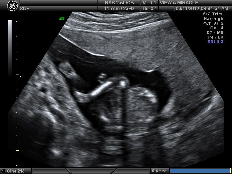 Name:  Adriana 16 weeks 003.jpg
Views: 2063
Size:  167.1 KB