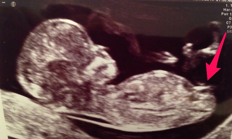 Name:  Baby Sono2b.jpg
Views: 1459
Size:  125.4 KB