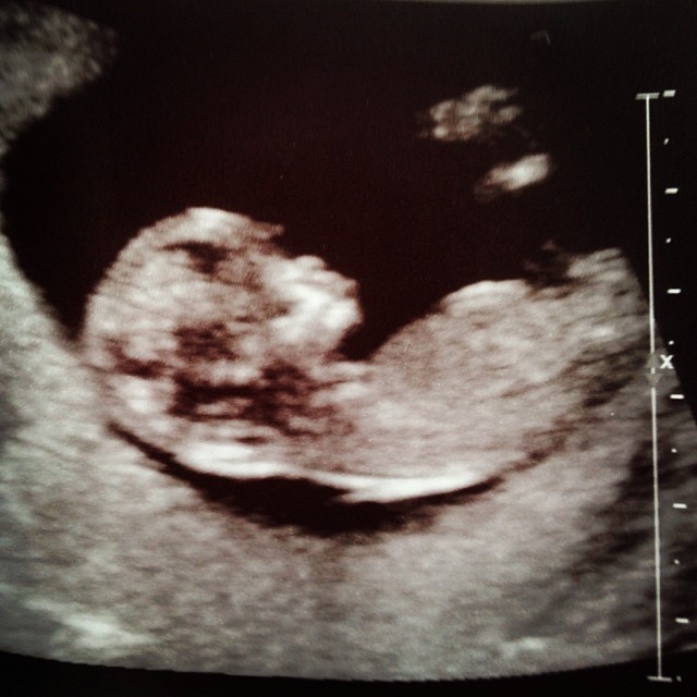 Name:  babyscully#2.jpg
Views: 72
Size:  71.9 KB