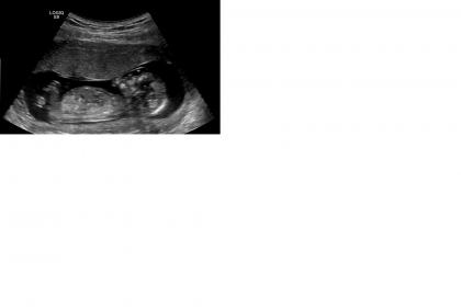 Name:  Kristens Baby.jpg
Views: 86
Size:  6.5 KB