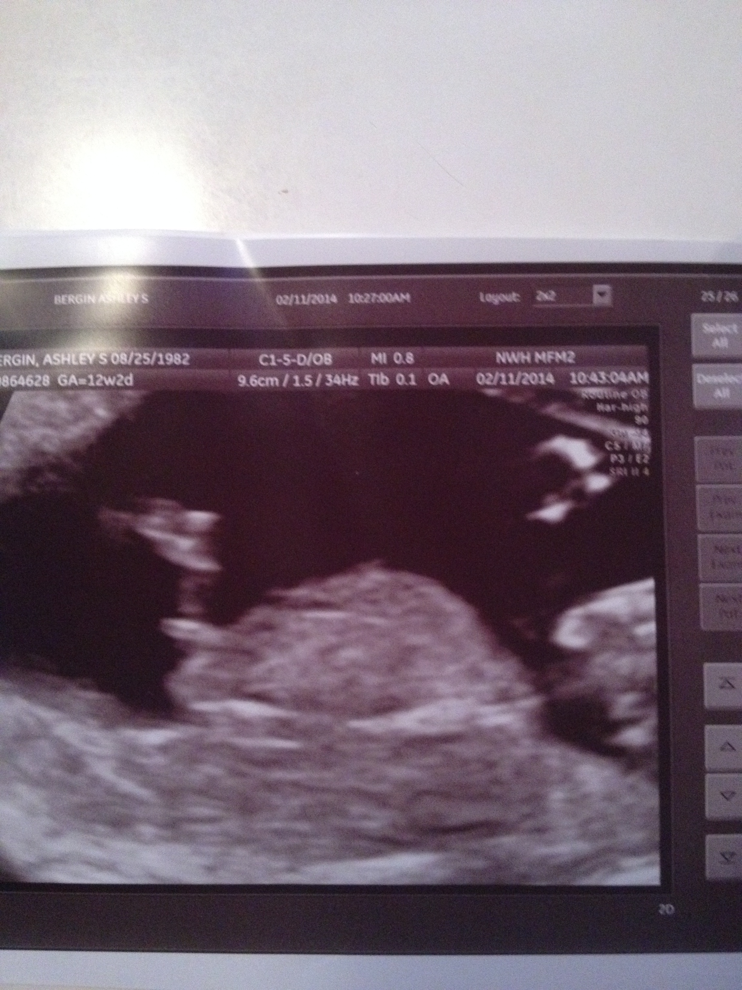 Name:  baby#4-2.JPG
Views: 222
Size:  2.46 MB