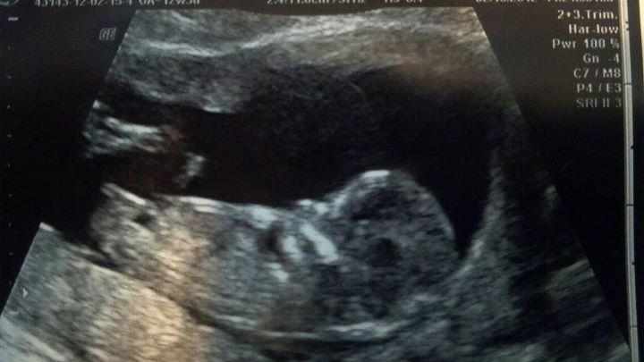 Name:  12 week.jpg
Views: 1592
Size:  34.9 KB