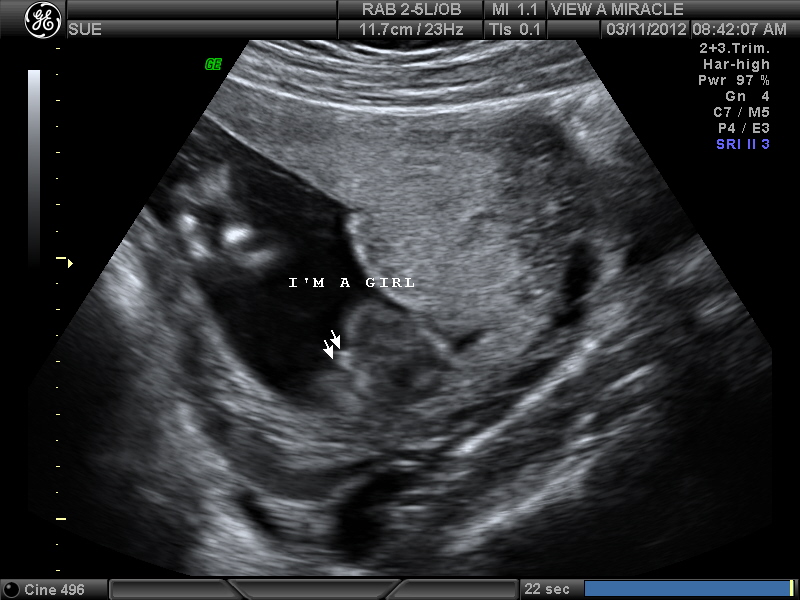 Name:  Adriana 16 weeks 004.jpg
Views: 3270
Size:  161.3 KB