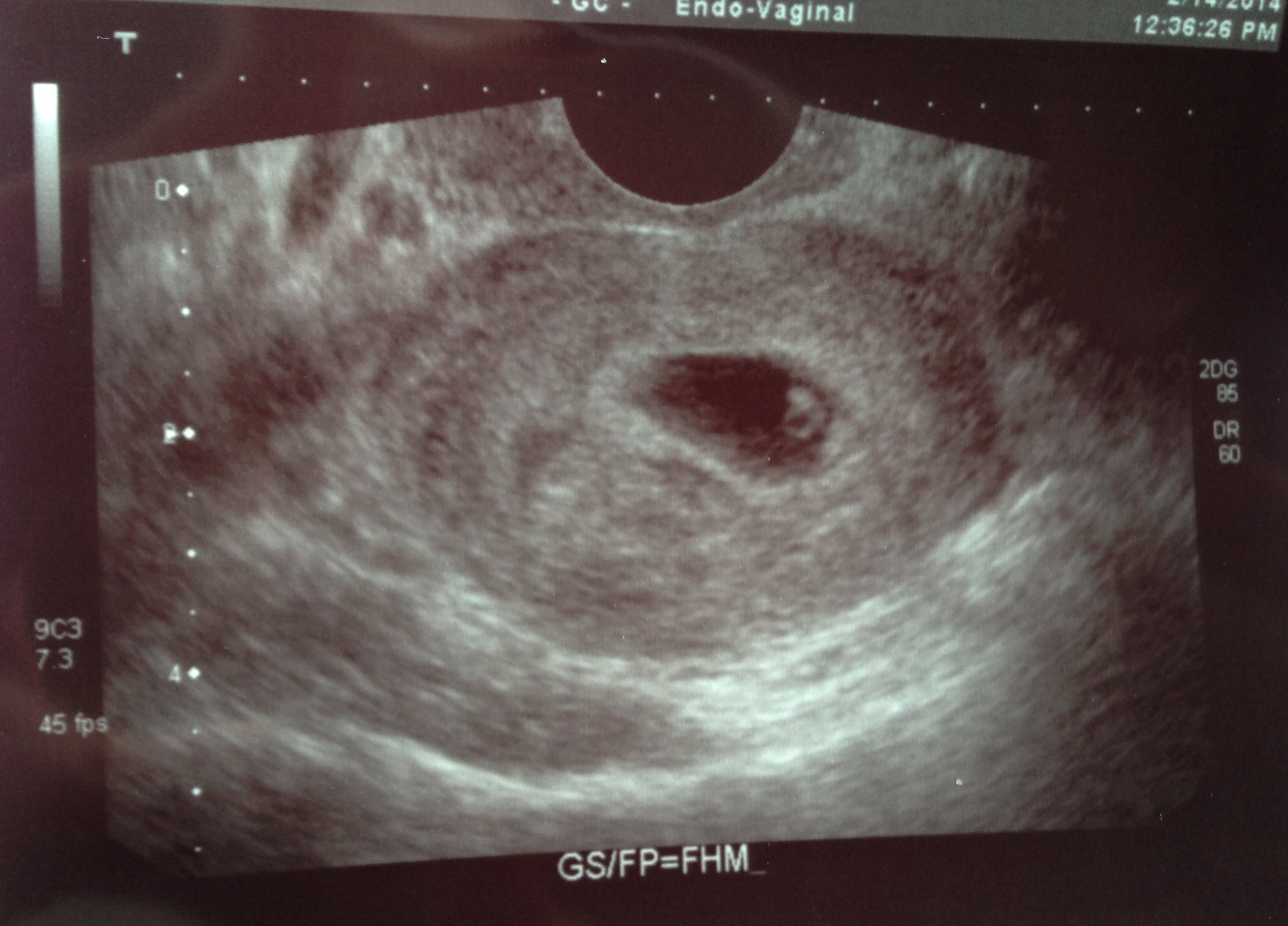 Name:  Babe3-Edit.jpg
Views: 155
Size:  1.03 MB