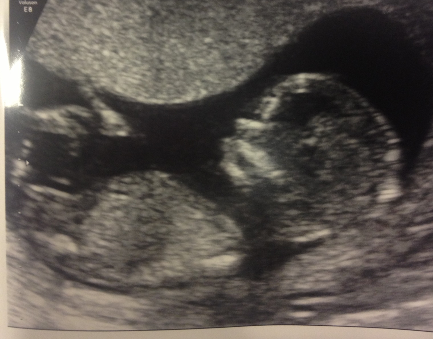 Name:  image.jpg
Views: 225
Size:  340.2 KB