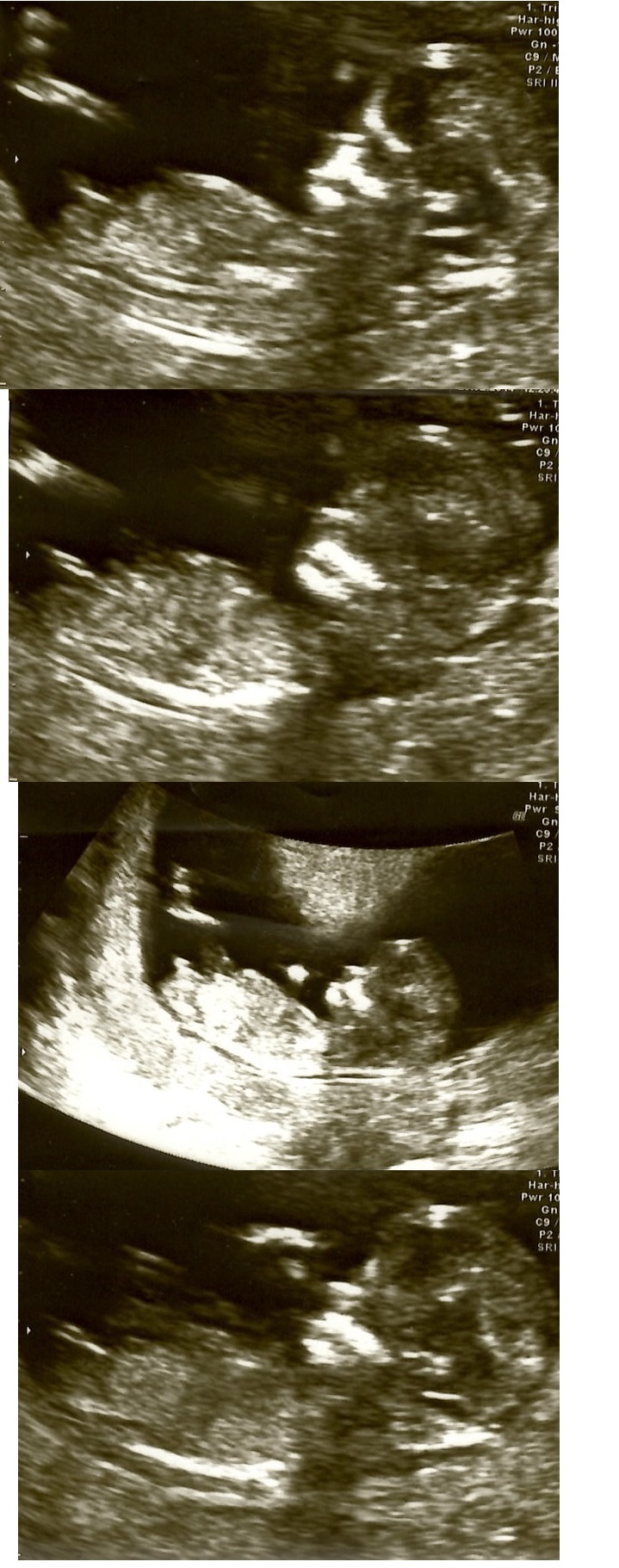 Name:  03 - 12 weeks C.JPG
Views: 399
Size:  337.3 KB