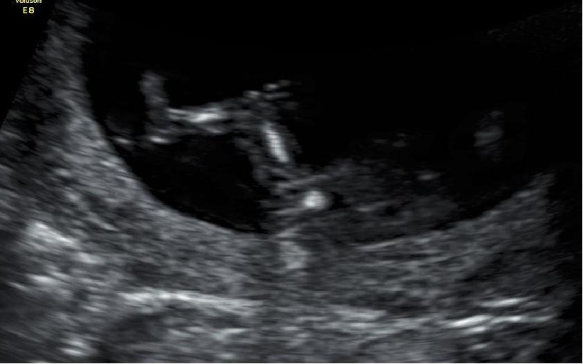Name:  Baby Legs Nub 3.JPG
Views: 413
Size:  38.3 KB