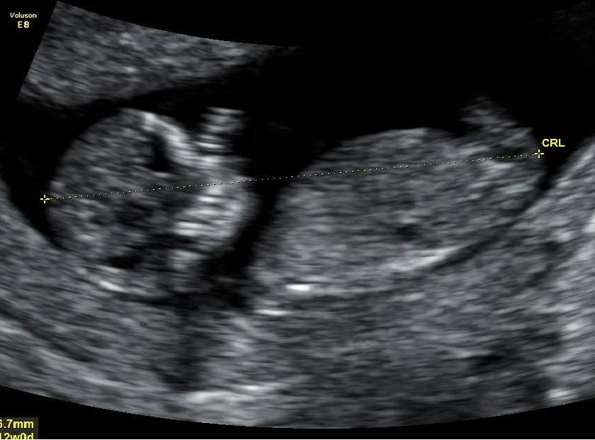 Name:  Baby Nub 2.JPG
Views: 691
Size:  54.4 KB