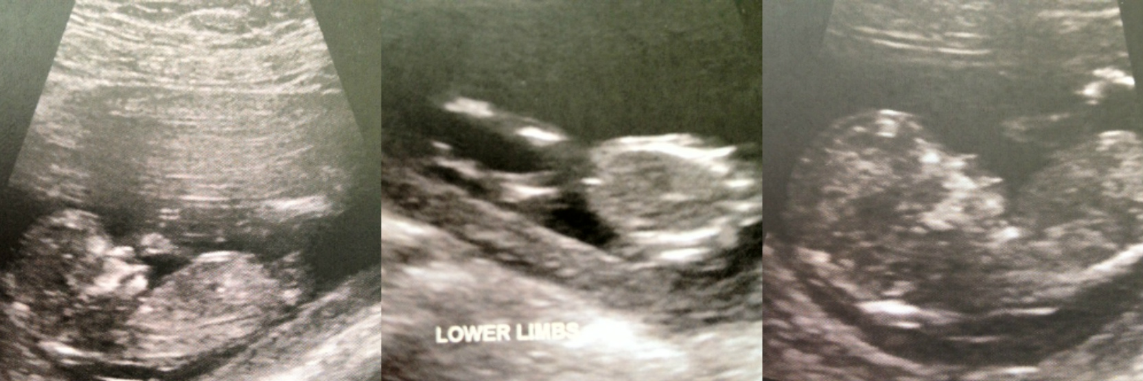 Name:  baby.jpg
Views: 109
Size:  311.4 KB