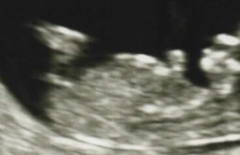 Name:  baby.jpeg
Views: 115
Size:  62.5 KB