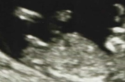 Name:  Image (3) - Copy.jpg
Views: 114
Size:  57.6 KB