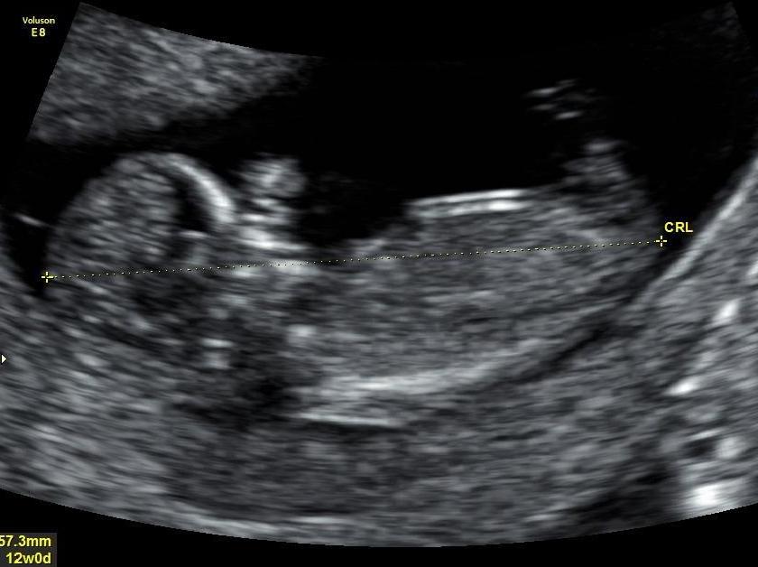 Name:  Baby Nub 3.JPG
Views: 243
Size:  54.4 KB