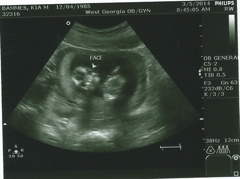 Name:  babybammes3m(1).jpg
Views: 213
Size:  358.4 KB