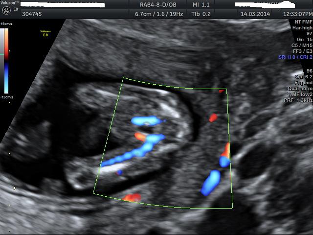 Name:  BABY_9.JPG
Views: 182
Size:  46.8 KB