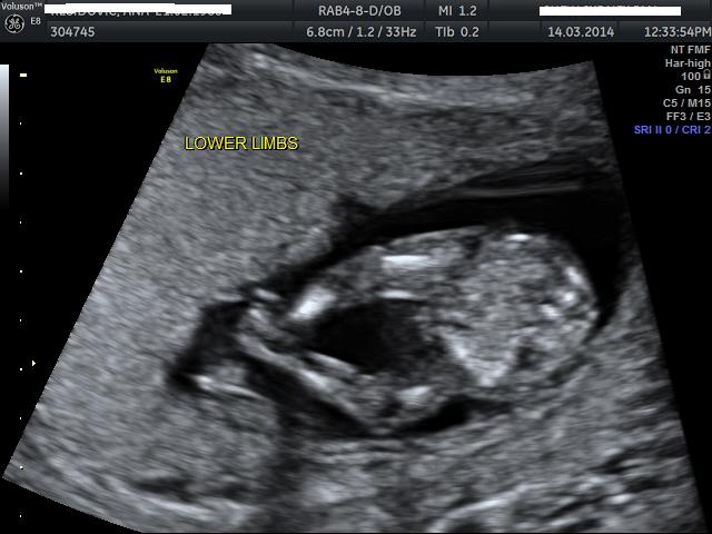 Name:  BABY_13.JPG
Views: 180
Size:  43.2 KB