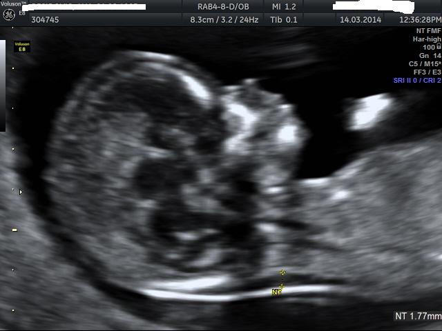 Name:  BABY_15.JPG
Views: 156
Size:  35.5 KB