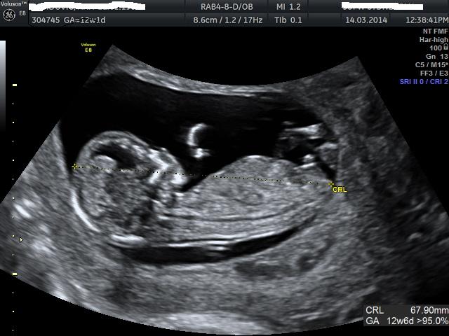 Name:  BABY_17.JPG
Views: 179
Size:  45.1 KB