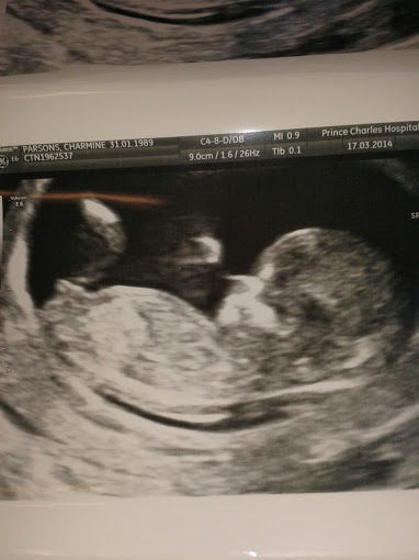 Name:  Scan 12 wks 3 days 3rd pic.jpg
Views: 258
Size:  32.9 KB