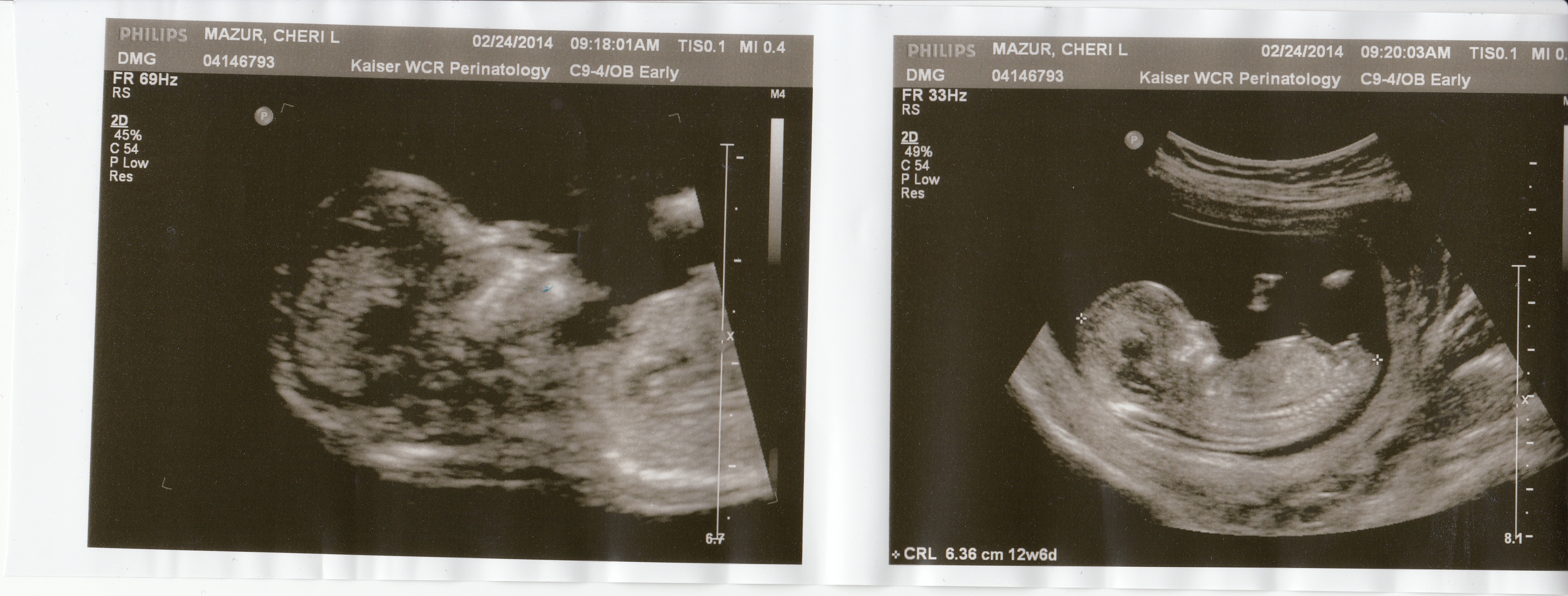 Name:  12WeekUltrasound.jpg
Views: 431
Size:  1.38 MB