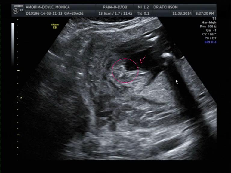 Name:  20weekpottyshot1.JPG
Views: 775
Size:  48.4 KB