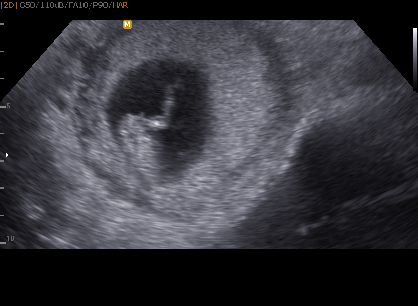 Name:  BABY _0005 (2).jpg
Views: 804
Size:  125.8 KB