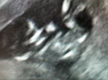 Name:  baby2.jpg
Views: 203
Size:  6.9 KB