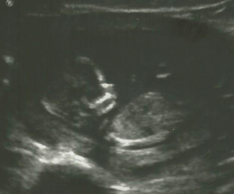 Name:  12-crop_zps07b45060.jpg
Views: 89
Size:  79.4 KB