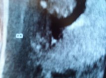 Name:  Baby B.jpg
Views: 399
Size:  7.5 KB