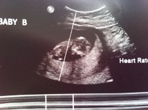 Name:  baby1.jpg
Views: 370
Size:  8.6 KB