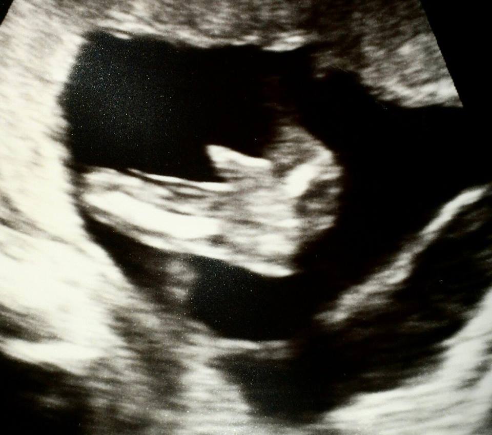 Name:  boy or cord.jpg
Views: 139
Size:  73.7 KB
