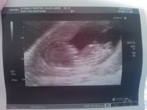 Name:  bean2.jpg
Views: 147
Size:  24.2 KB