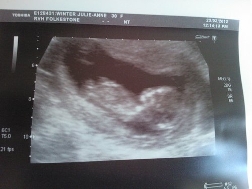 Name:  bean3.jpg
Views: 145
Size:  28.1 KB