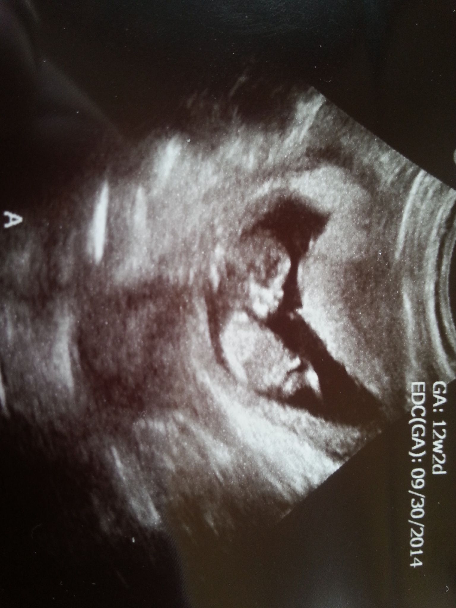 Name:  BabyA_12wks.jpg
Views: 769
Size:  271.4 KB
