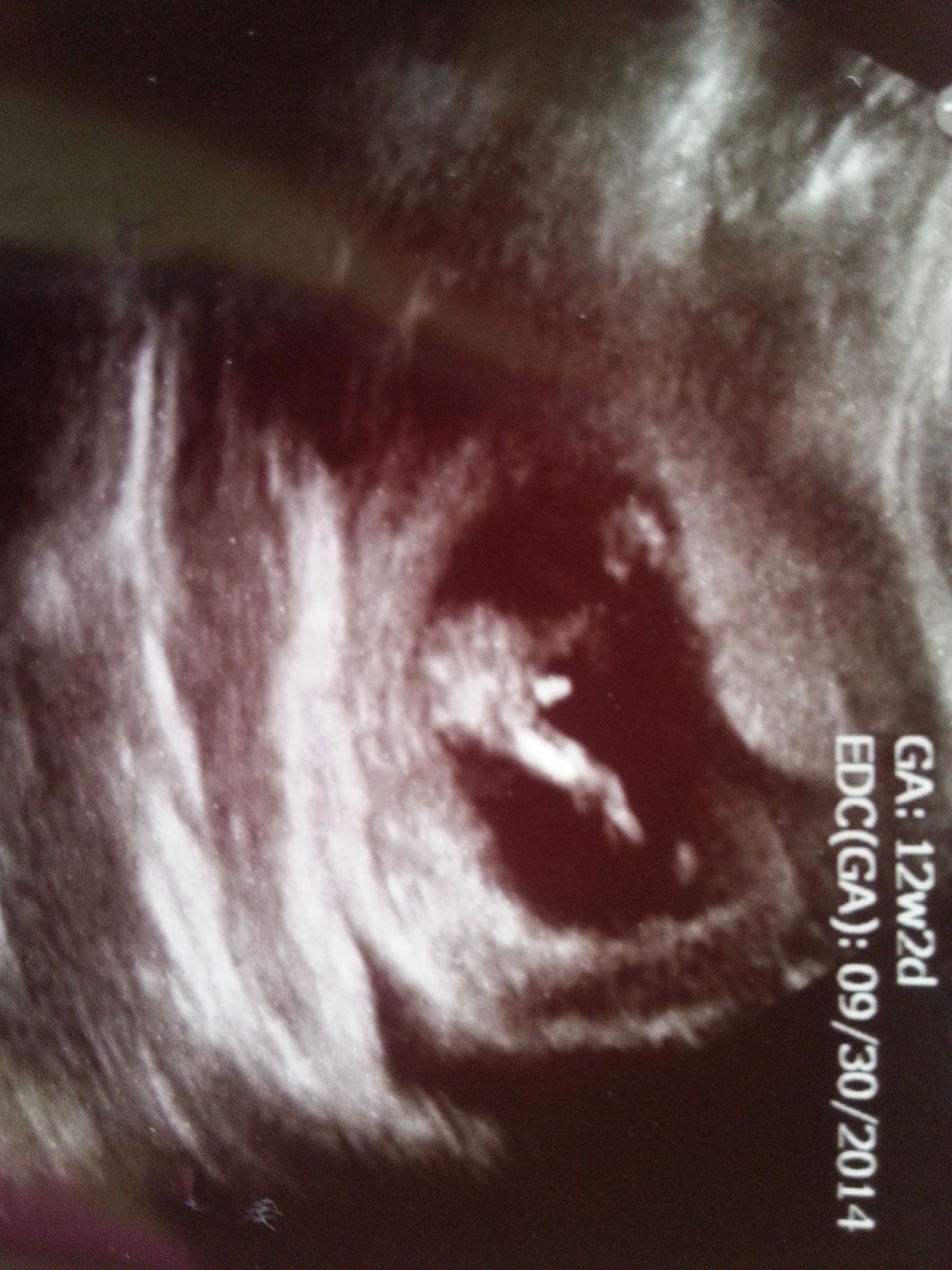Name:  babya2_12wks.jpg
Views: 436
Size:  334.3 KB